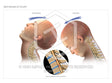 Image 10568_im02: Mechanism of Injury Illustration - Trial Guides