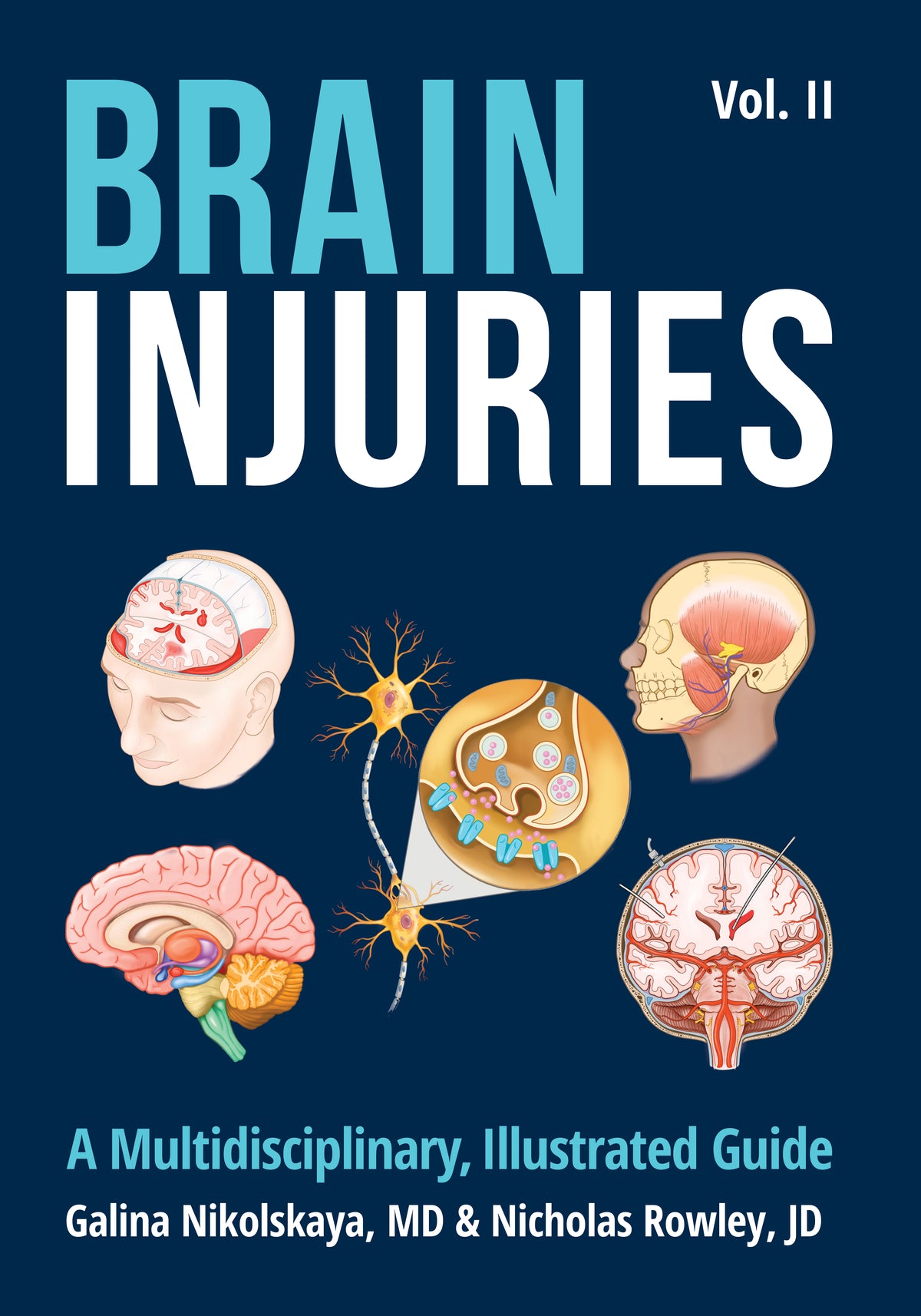Brain Injuries: A Multidisciplinary, Illustrated Guide