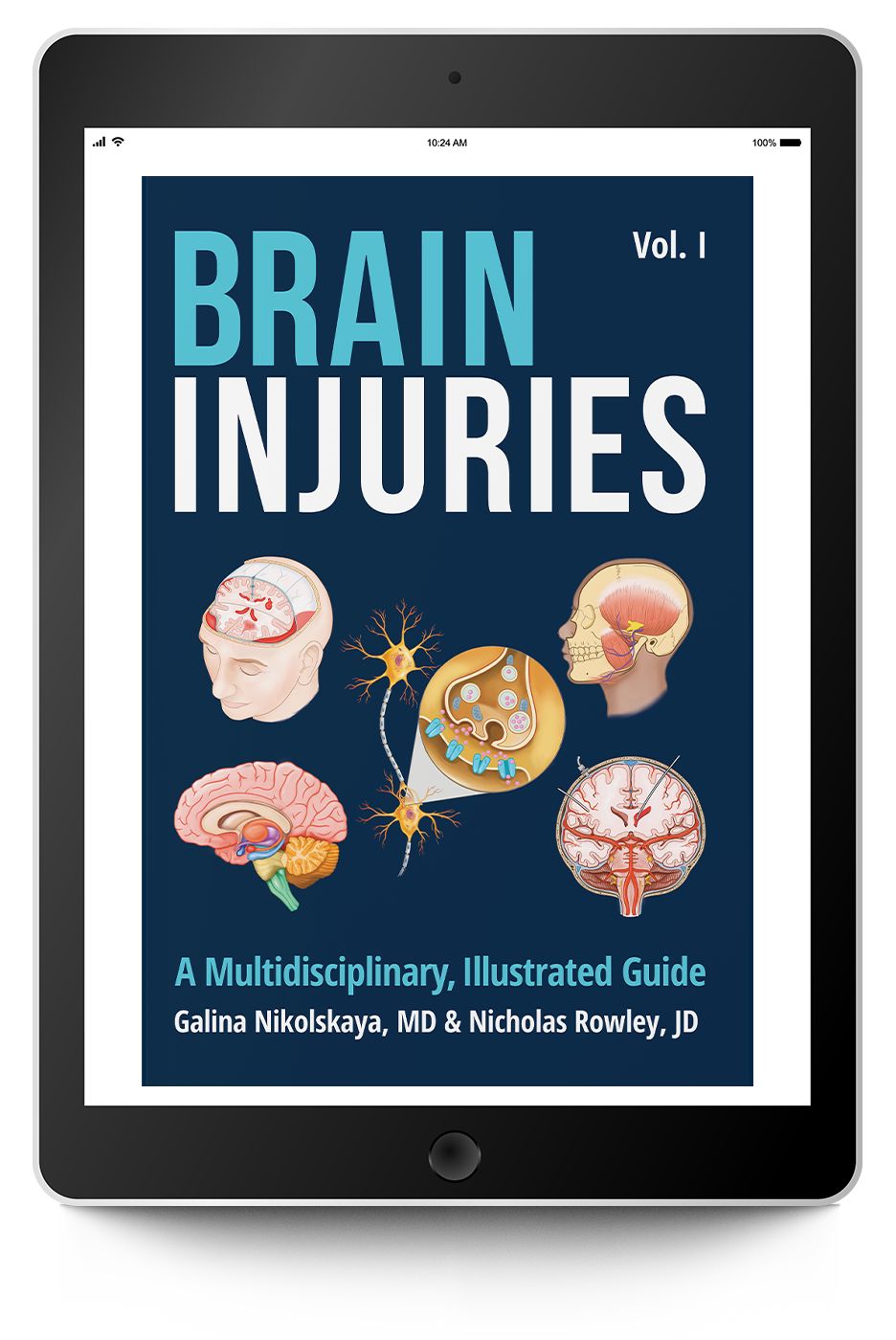 Brain Injuries: A Multidisciplinary, Illustrated Guide