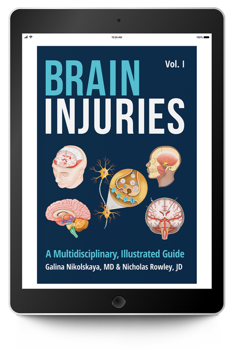 Brain Injuries: A Multidisciplinary, Illustrated Guide
