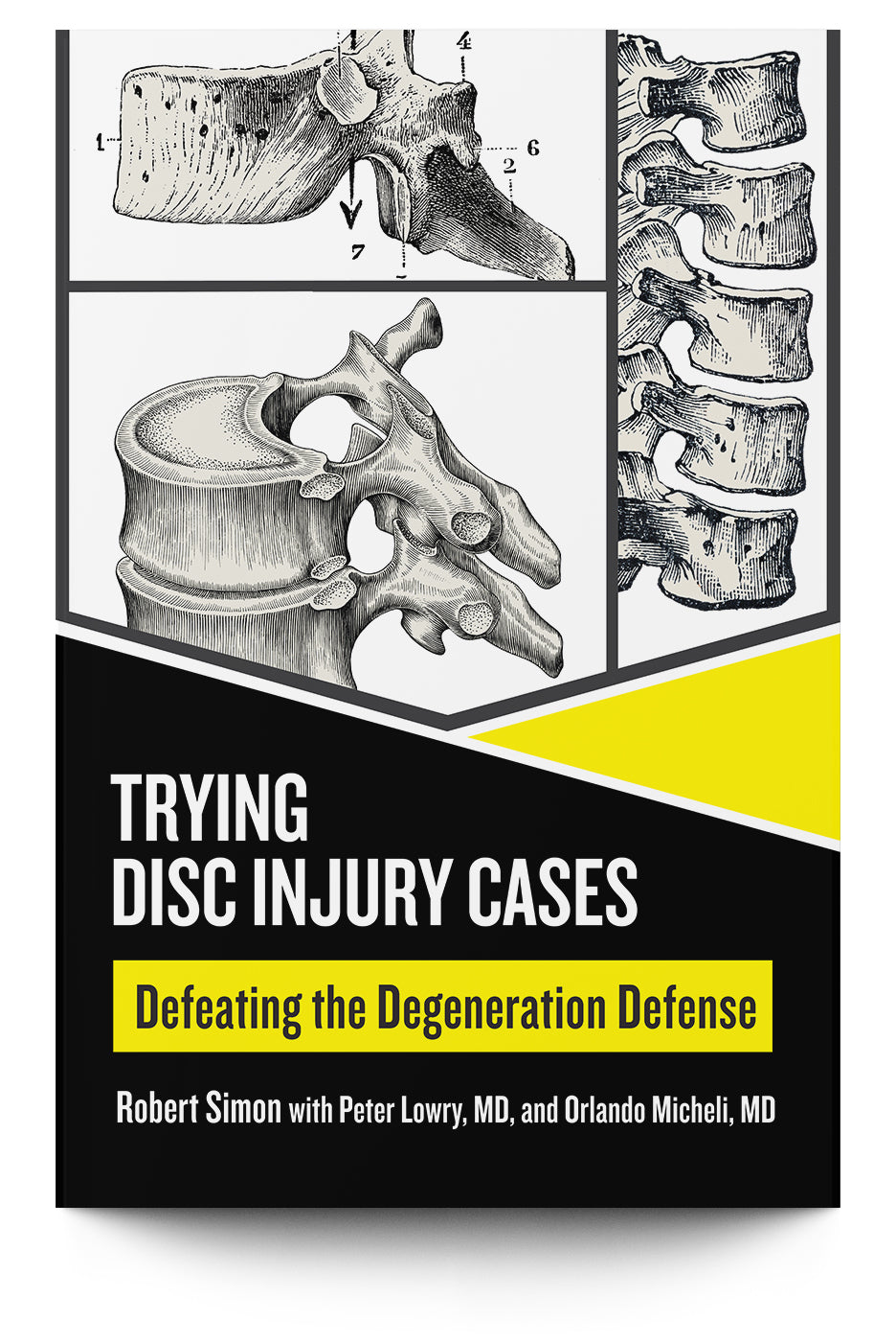 Connective Tissue/Whiplash Illustrations – Trial Guides