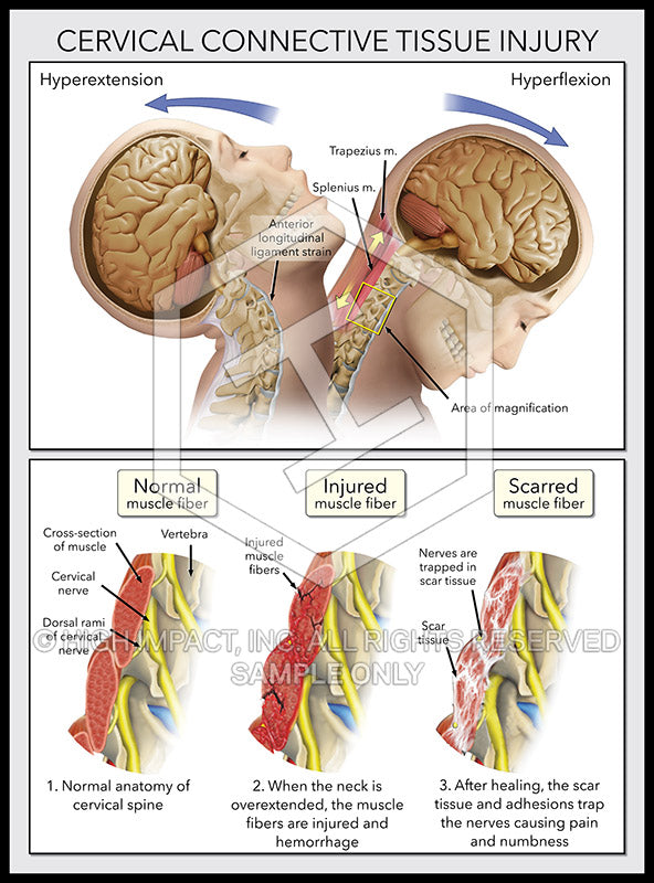 cervical spine damage symptoms