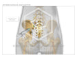 Image 14518: Sacroiliac Joint Injections Illustration - Trial Guides