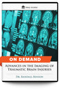 Advances in the Imaging of Traumatic Brain Injuries - On Demand - Trial Guides
